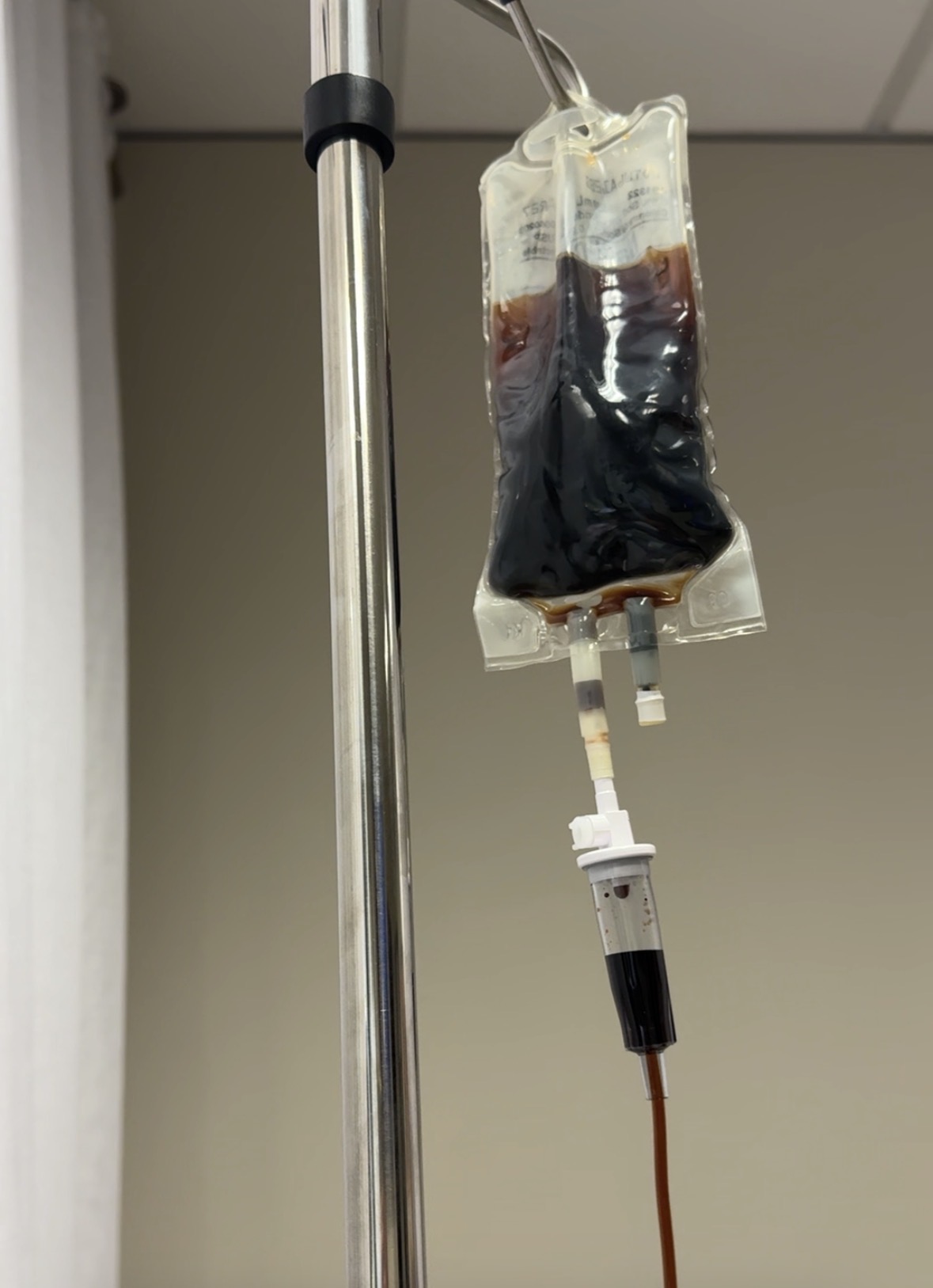 IV Iron infusion